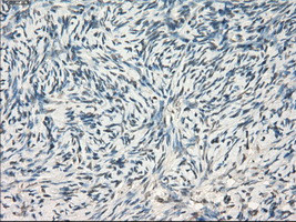 LTA4H Antibody in Immunohistochemistry (Paraffin) (IHC (P))