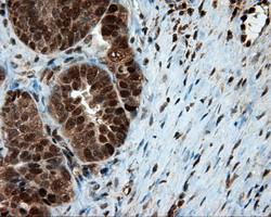 LTA4H Antibody in Immunohistochemistry (Paraffin) (IHC (P))