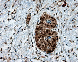 LTA4H Antibody in Immunohistochemistry (Paraffin) (IHC (P))