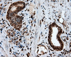 LTA4H Antibody in Immunohistochemistry (Paraffin) (IHC (P))