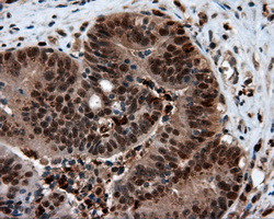 LTA4H Antibody in Immunohistochemistry (Paraffin) (IHC (P))