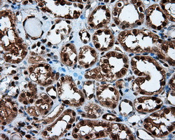 LTA4H Antibody in Immunohistochemistry (Paraffin) (IHC (P))