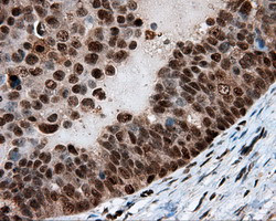 LTA4H Antibody in Immunohistochemistry (Paraffin) (IHC (P))