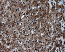 LTA4H Antibody in Immunohistochemistry (Paraffin) (IHC (P))