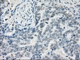 LTA4H Antibody in Immunohistochemistry (Paraffin) (IHC (P))