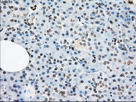 LTA4H Antibody in Immunohistochemistry (Paraffin) (IHC (P))