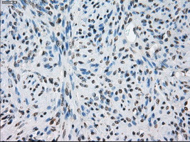 LTA4H Antibody in Immunohistochemistry (Paraffin) (IHC (P))