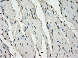 LTA4H Antibody in Immunohistochemistry (Paraffin) (IHC (P))