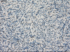 LTA4H Antibody in Immunohistochemistry (Paraffin) (IHC (P))