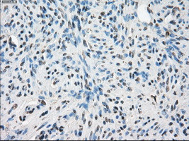 LTA4H Antibody in Immunohistochemistry (Paraffin) (IHC (P))