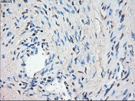 LTA4H Antibody in Immunohistochemistry (Paraffin) (IHC (P))