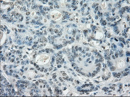 LTA4H Antibody in Immunohistochemistry (Paraffin) (IHC (P))