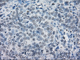 LTA4H Antibody in Immunohistochemistry (Paraffin) (IHC (P))