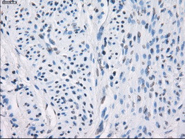 LTA4H Antibody in Immunohistochemistry (Paraffin) (IHC (P))