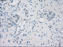 LTA4H Antibody in Immunohistochemistry (Paraffin) (IHC (P))