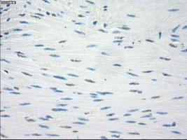 LTA4H Antibody in Immunohistochemistry (Paraffin) (IHC (P))