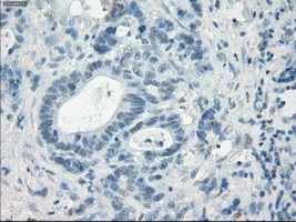 LTA4H Antibody in Immunohistochemistry (Paraffin) (IHC (P))