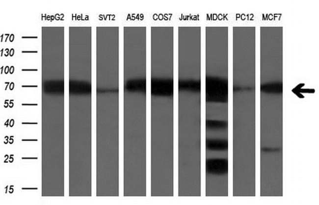 LTA4H Antibody in Western Blot (WB)