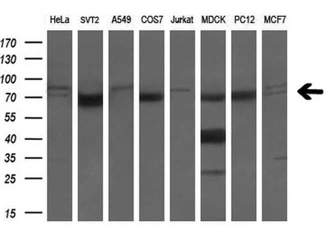 LTA4H Antibody in Western Blot (WB)