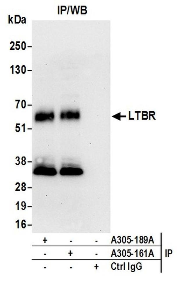 LTBR/Lymphotoxin-beta Receptor Antibody in Western Blot (WB)