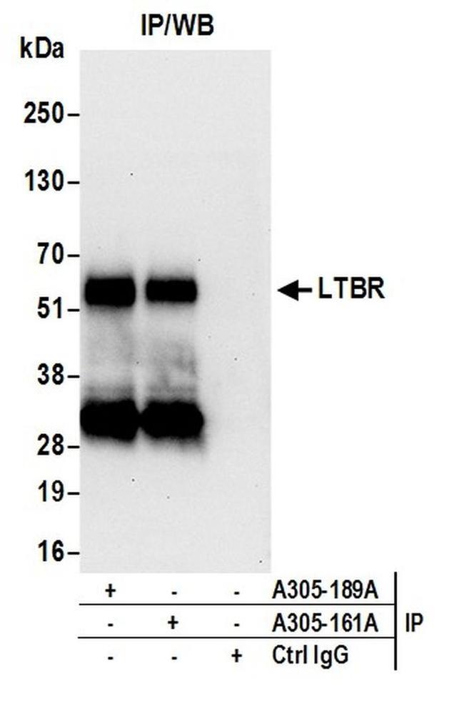 LTBR/Lymphotoxin-beta Receptor Antibody in Western Blot (WB)