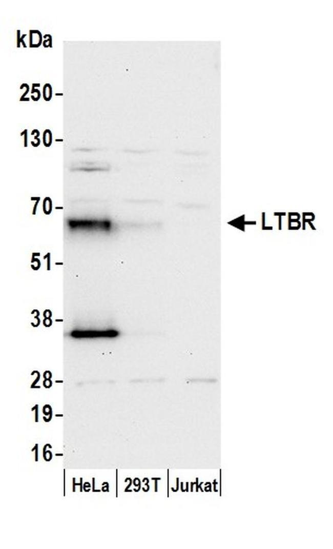 LTBR/Lymphotoxin-beta Receptor Antibody in Western Blot (WB)