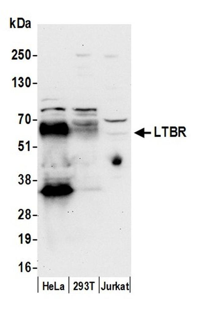 LTBR/Lymphotoxin-beta Receptor Antibody in Western Blot (WB)