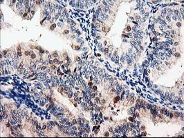 LXN Antibody in Immunohistochemistry (Paraffin) (IHC (P))