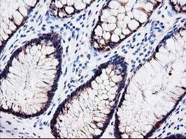 LXN Antibody in Immunohistochemistry (Paraffin) (IHC (P))