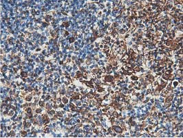 LXN Antibody in Immunohistochemistry (Paraffin) (IHC (P))