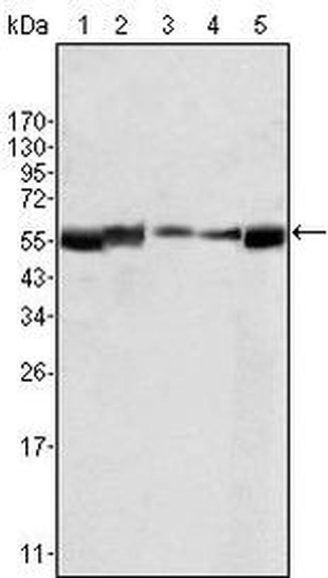 Lyn Antibody in Western Blot (WB)