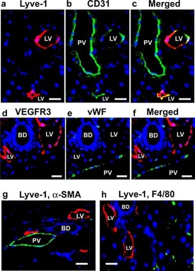 LYVE1 Antibody in Immunohistochemistry (IHC)