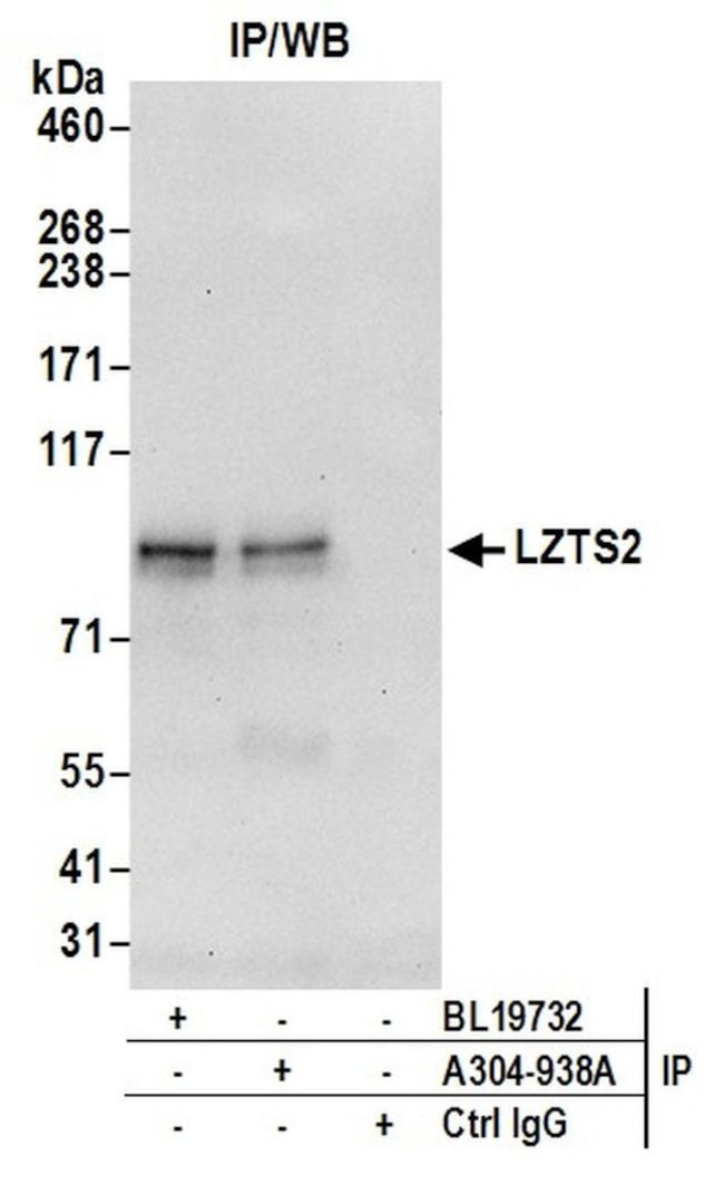 LZTS2 Antibody in Immunoprecipitation (IP)