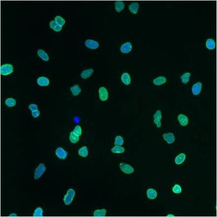 Lamin A/C Antibody in Immunocytochemistry (ICC/IF)