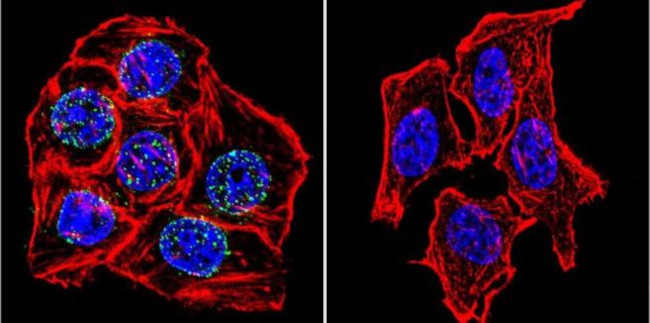 Lamin A/C Antibody in Immunocytochemistry (ICC/IF)