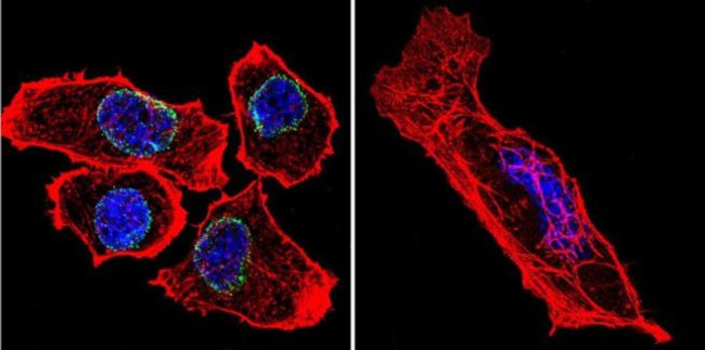 Lamin A/C Antibody in Immunocytochemistry (ICC/IF)