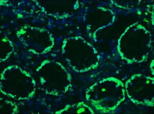 Lamin B1 Antibody in Immunohistochemistry (Frozen) (IHC (F))