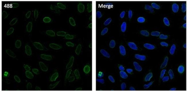 Lamin B2 Antibody in Immunocytochemistry (ICC/IF)