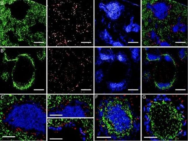 CD207 (Langerin) Antibody in Immunocytochemistry (ICC/IF)