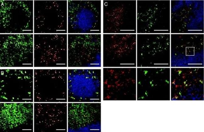 CD207 (Langerin) Antibody in Immunocytochemistry (ICC/IF)