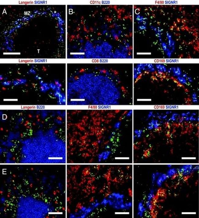 CD207 (Langerin) Antibody in Immunocytochemistry (ICC/IF)