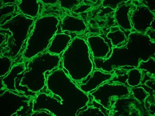 Perlecan Antibody in Immunohistochemistry (Frozen) (IHC (F))