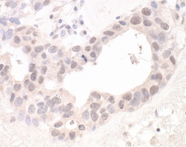 Lasu1/Ureb1 Antibody in Immunohistochemistry (IHC)