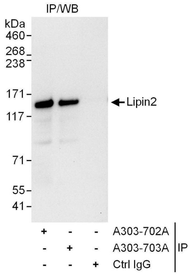 Lipin2 Antibody in Immunoprecipitation (IP)