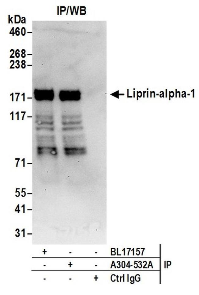 Liprin-alpha-1 Antibody in Western Blot (WB)