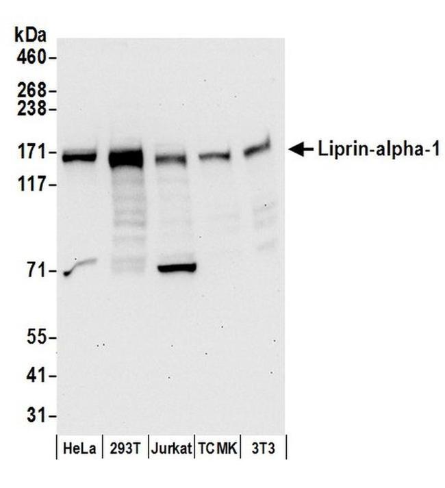 Liprin-alpha-1 Antibody in Western Blot (WB)