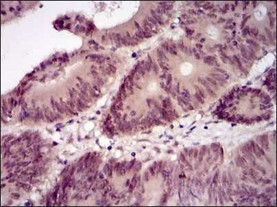 Lplunc1 Antibody in Immunohistochemistry (Paraffin) (IHC (P))