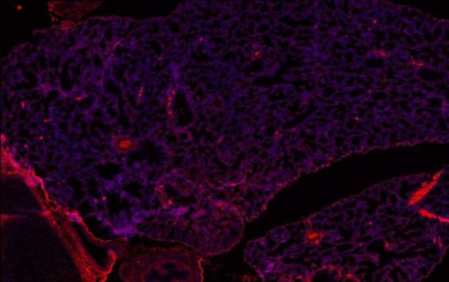 LRP1 Antibody in Immunohistochemistry (Paraffin) (IHC (P))