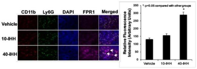 Ly-6G Antibody in Immunohistochemistry (IHC)