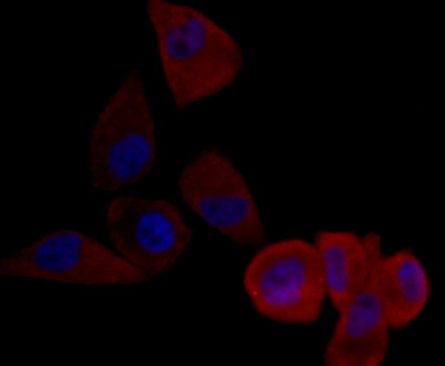 Cytokeratin 17 Antibody in Immunocytochemistry (ICC/IF)